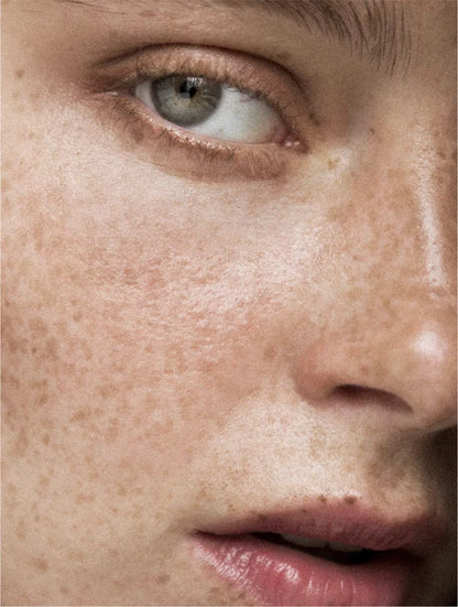 Sérum Correcteur de Pigmentation Visage – 30 ml Selfnamed
